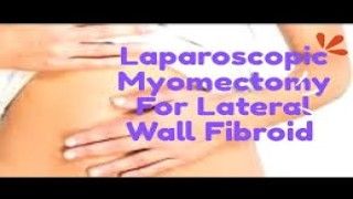 Laparoscopic Hysterectomy with Ureteral Stent Placement