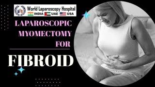 How to perform safe Dermoid Ovarian Cystectomy without Spillage