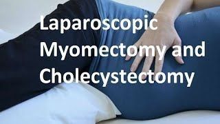 Total Laparoscopic Hysterectomy for Very Large Uterus with Huge Fibroid