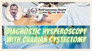 Laparoscopic Inguinal Hernia Surgery Explained Step by Step