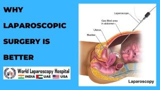 Laparoscopic Hand Instrument Demonstration Part 2 by Dr R K Mishra