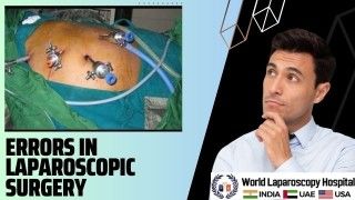 Errors in Laparoscopic Surgery: A Surgeon's Guide to Minimizing Risk and Maximizing Patient Safety