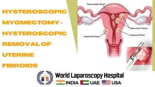 Laparoscopic Hand Instrument Demonstration Part 2 by Dr R K Mishra