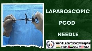 Ruptured Ectopic Pregnancy surgery by Laparoscopy