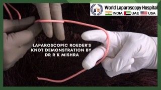 Laparoscopic Access Technique using Veress Needle