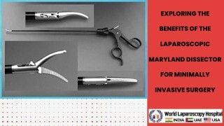 Exploring the Benefits of the Laparoscopic Maryland Dissector for Minimally Invasive Surgery