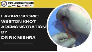 Laparoscopic Weston Knot