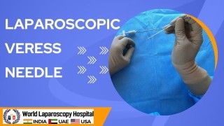 Exploring the Laparoscopic Veress Needle: A Key Instrument for Minimally Invasive Surgery