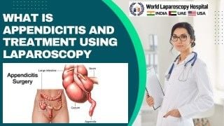 Understanding Appendicitis: Causes, Symptoms, and Laparoscopic Treatment Options for Quick Recovery