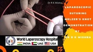 Watch Dr. R K Mishra's Expert Demonstration of Melzer's Knot Technique