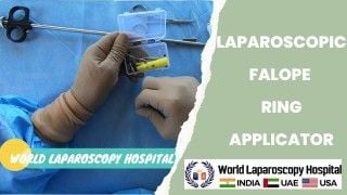 Maximizing Surgical Precision with Laparoscopic Falope Ring Applicator: A Comprehensive Guide