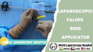 Laparoscopic Linear Cutter Staplers