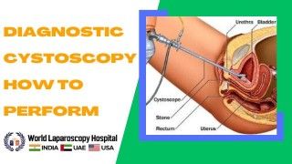 Mastering the Technique: A Guide to Performing Diagnostic Cystoscopy