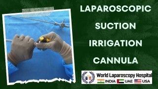 Discovering the Benefits of Laparoscopic Suction Irrigation Cannula: A Comprehensive Overview