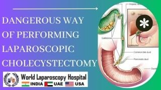 IPOM Inguinal Hernia by Dr. R. K. Mishra