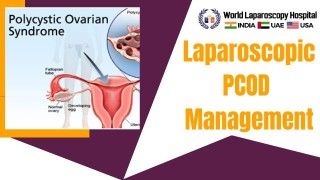 Effective Management of PCOD through Laparoscopic Techniques: Empowering Women's Health