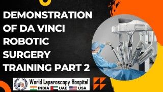Dr R K Mishra Explaining Laparoscopic Cholecystectomy