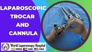 Minimally invasive precision: Laparoscopic trocars and cannula