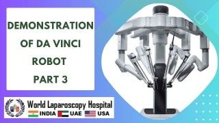 Unleashing surgical mastery: Witness the advanced capabilities of the Da Vinci Robot(Part 3)