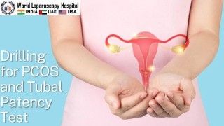 What causes Infertility in women and how can it be treated by Laparoscopy?