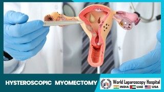 Enhancing Treatment : Laparoscopic Myomectomy for Large Submucous Fibroids Unveils New Possibilities