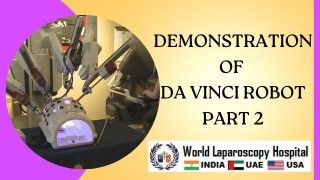 Unlock the future of surgery with Da Vinci Robot Part 2