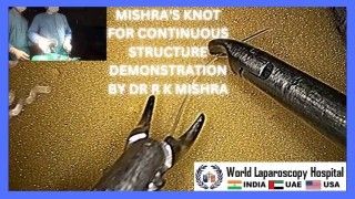 Dr. R K Mishra Demonstrates Continuous Structure Technique with Surgical Precision