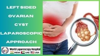 Laparoscopic Surgery for Left Ovarian Dermoid Cyst