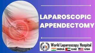 Laparoscopic PCOD Management