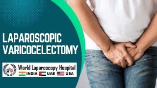 Laparoscopic Varicocelectomy: Minimally Invasive Treatment for Varicoceles