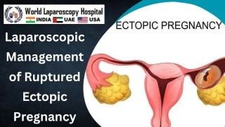 Myomectomy and Dermoid Ovarian Cystectomy