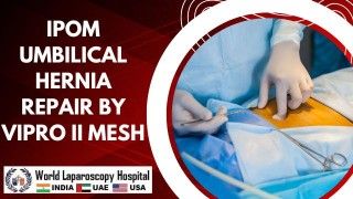 Laparoscopic Nephrectomy Lecture by Dr R K Mishra