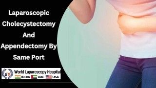 One Port, Two Procedures: Simultaneous Laparoscopic Cholecystectomy and Appendectomy