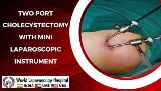 An Overview of Upper and Lower GI Endoscopy