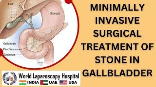 IPOM Inguinal Hernia Surgery