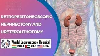 Advancing Surgical Techniques: Exploring Retroperitoneoscopic Nephrectomy and Ureterolithotomy