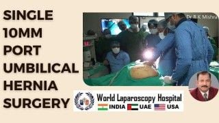 Revolutionizing Umbilical Hernia Surgery: Single 10mm Port Technique