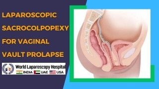 Laparoscopic Repair of Para Umbilical Hernia by Dr R K Mishra