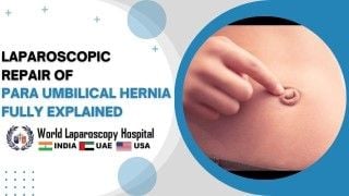 Laparoscopic Bilateral Inguinal Hernia Repair Offers Minimally Invasive Solution