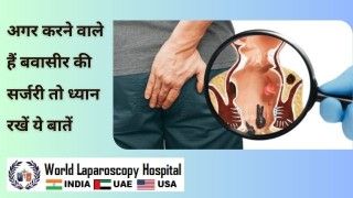 Laparoscopic Scissors