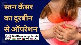स्तन कैंसर के इलाज में दूरबीन का उपयोग करने वाली सर्जरी