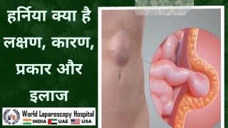 हर्निया: लक्षण, कारण, प्रकार और इलाज के बारे में जानें