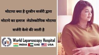 दूरबीन सर्जरी: मोटापे का इलाज करने के लिए लेप्रोस्कोपिक मोटापा सर्जरी का आद्यात्मिक निवारण