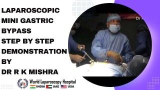 Laparoscopic Repair of Large Suprapubic Hernias