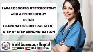Total Laparoscopic Hysterectomy by Two 5 mm Ports - Single Instrument Surgery