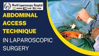 Laparoscopic inguinal hernia repair "IPOM" with Dual-Mesh