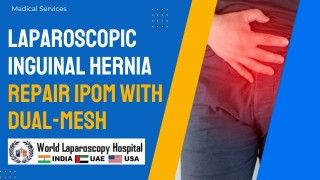 हर्निया: लेप्रोस्कोपिक सर्जरी का एक आधुनिक उपाय, लक्षण, स्थान, कारण और इलाज