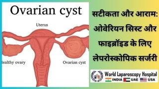 लेपरोस्कोपिक सर्जरी: सटीकता और आराम के साथ ओवेरियन सिस्ट और फाइब्रॉइड का इलाज