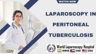 Laparoscopy: Revolutionizing Peritoneal Tuberculosis Diagnosis and Treatment