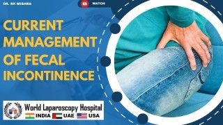 Contemporary Strategies in Fecal Incontinence Management: A Comprehensive Overview